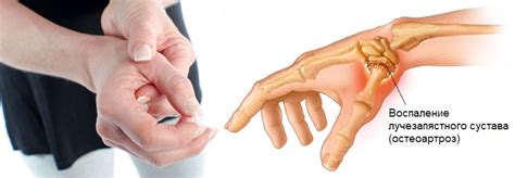Воспаление и боль в суставе пальца